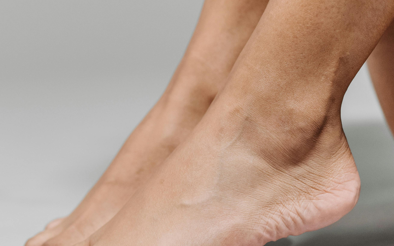 Arch Pain Treatment