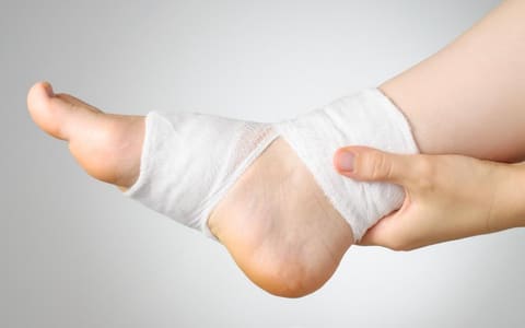 Ankle Sprains